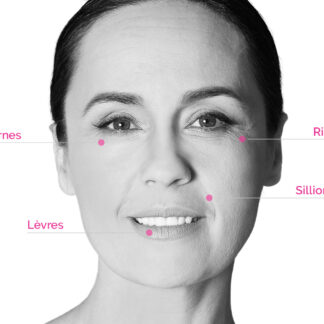 Retrouver une belle peau grâce aux injections d’acide hyaluronique