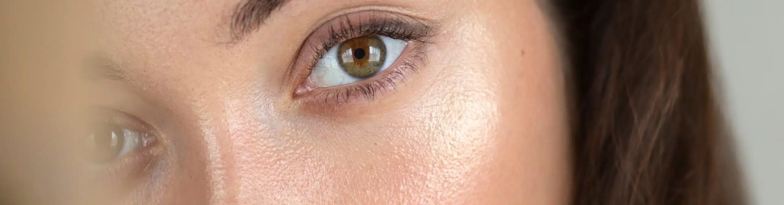 Comment agrandir son regard : injection acide hyaluronique à Antibes proche de Cannes | Dr Aimé