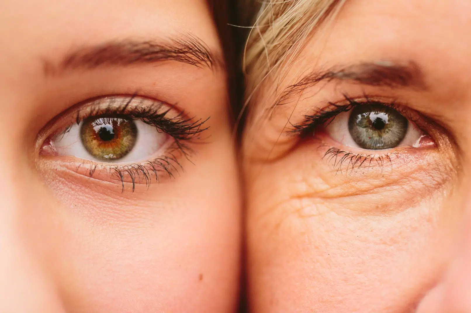 Les yeux de deux femme une agee et une jeune Qu est ce que le Plexr Plasma | Dr Aime Antibes. Cannes, Nice