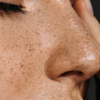 Mésothérapie pour un glow immédiat : à quel moment la programmer avant un événement ?