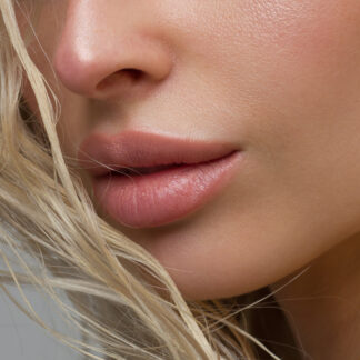 Acide hyaluronique pour les lèvres : hydratation subtile ou volume glamour ?