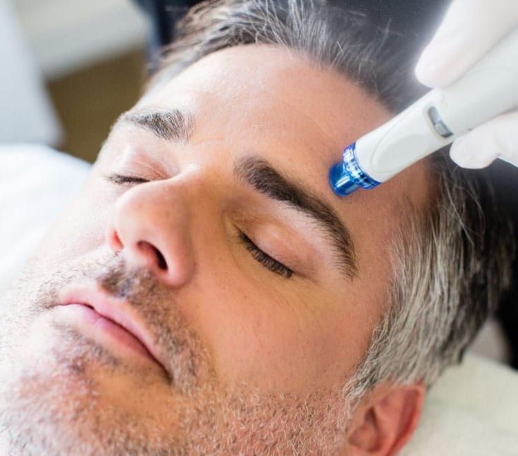 hydrafacial nice